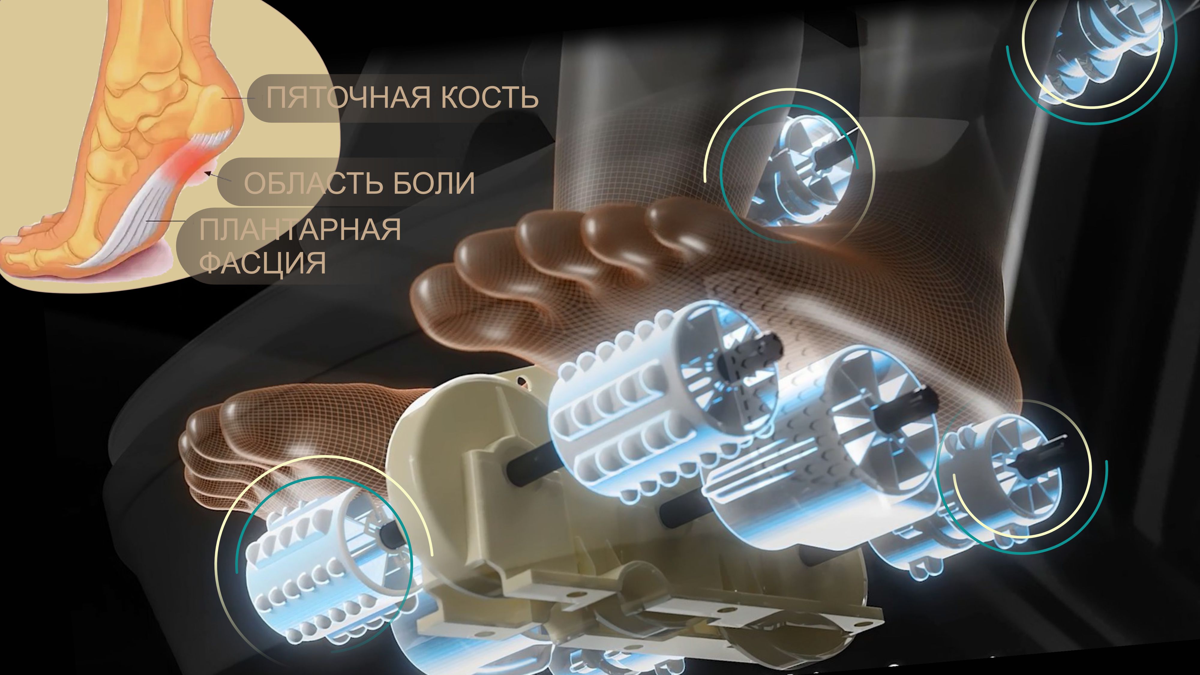 Плантарный массаж стоп - Массажное кресло Bodo Mesa Light Gray